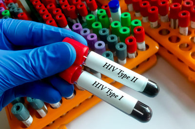 HIV testing tubes labeled 'HIV Type I' and 'HIV Type II' held by a gloved hand with test tubes in the background.